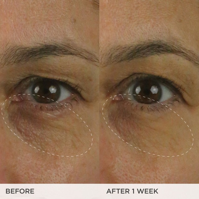 Before & After of model - Brightening Eye Cream