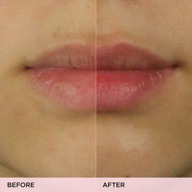 The Kissu Lip Scrub Before & After