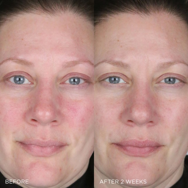 The Indigo Calming Cream Before & After