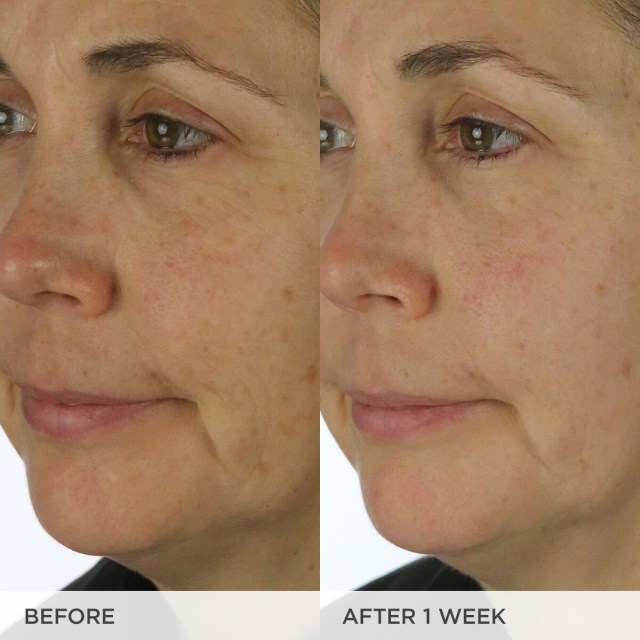 The Silk Cream Before & After