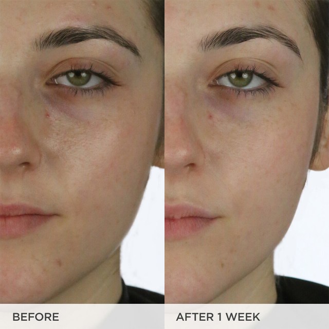 O Creme de Água Antes e Depois